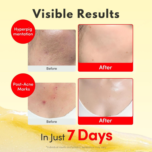 Vitamin Illuminating Serum & Cream Set