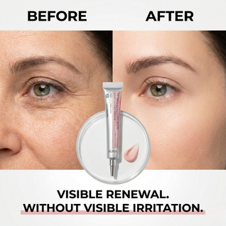 AURA Collagen Retinal Shot