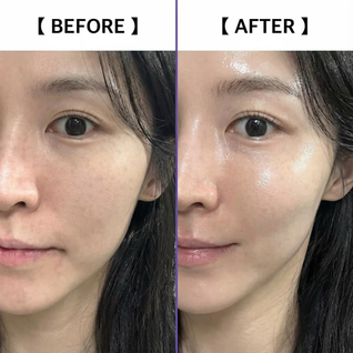 Korean Hyaluronic Salmon DNA Orb Serum